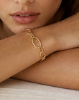 Bracelet Benito porté au poignet style chic et élégant femme – Jossepo